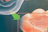 试管婴儿自然周期：方案揭秘，移植前工作与步骤详解