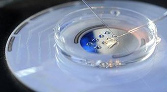 泰国做三代试管婴儿的费用准备多少才足够？